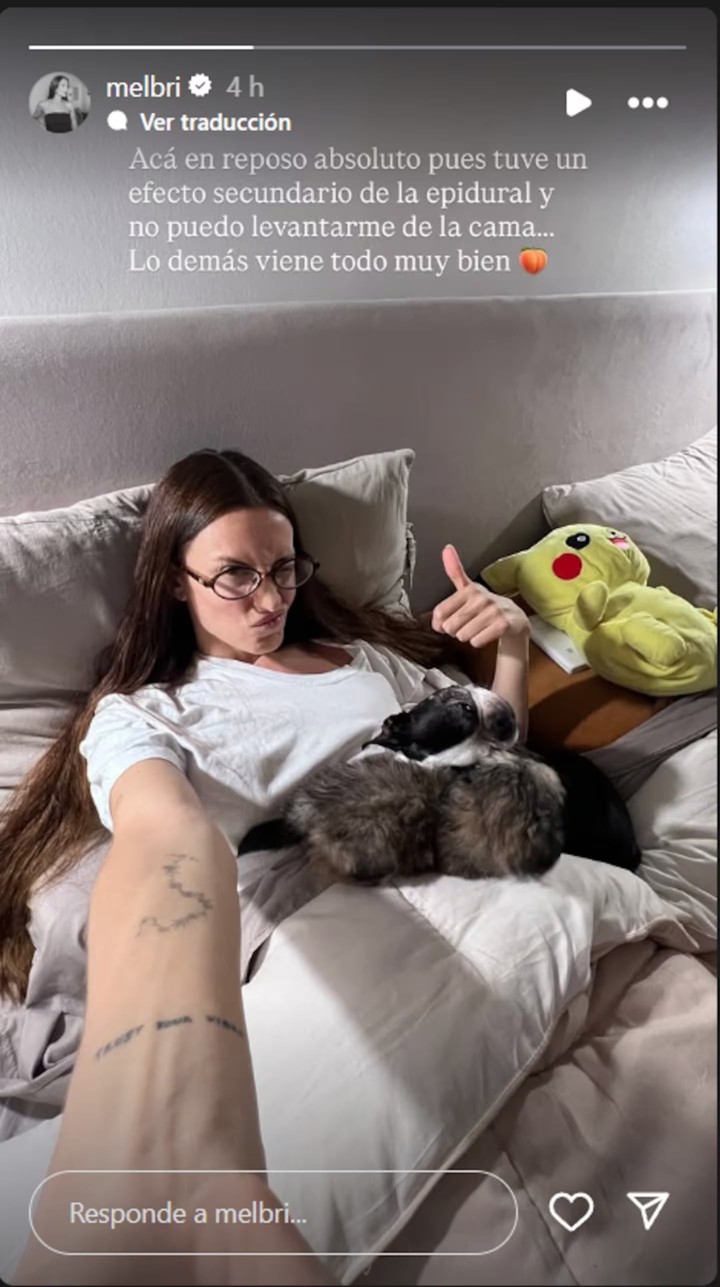 Melina Brizuela reveló cómo se recupera de la cirugía