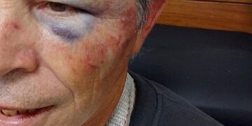 El hombre de 61 años fue golpeado ferozmente por otro conductor.