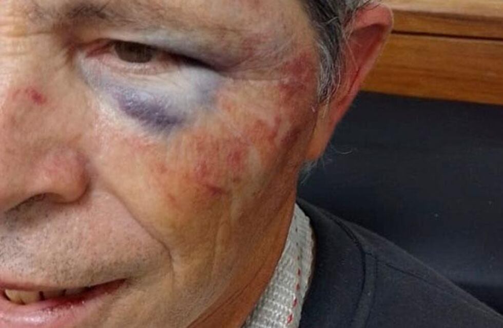 Violencia en Córdoba: una discusión de tránsito terminó con un hombre de 61 años en el hospital