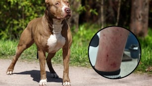 Una mujer soltó a sus perros para que atacaran a la Policía.