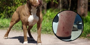 Una mujer soltó a sus perros para que atacaran a la Policía.