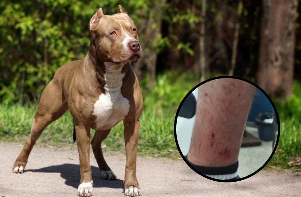 Insólito: soltó a dos pitbulls para atacar a policías en un operativo en Córdoba