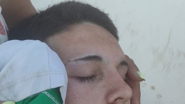 Jugador de futbol del Cultural Arroyito agredido