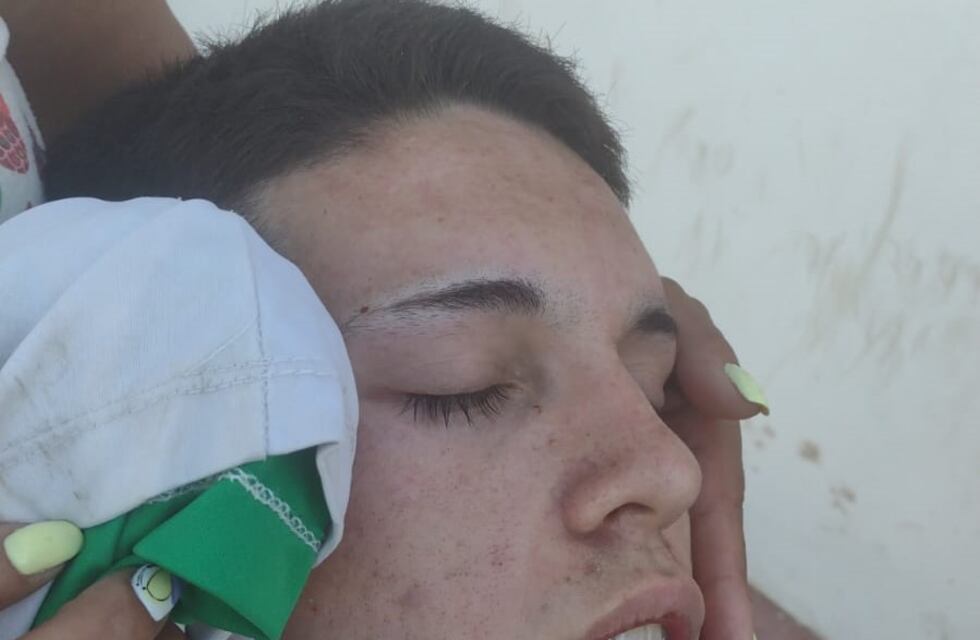 Un futbolista de inferiores del Cultural Arroyito fue agredido en el partido de la categoría juvenil en Río Primero
