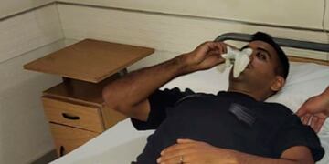 Uno de los efectivos atacados en Villa La Tela. (Policía)