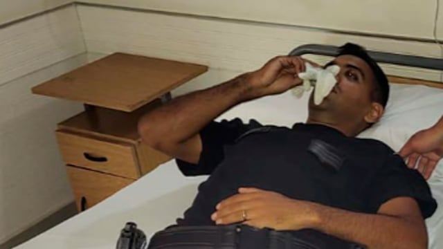 Uno de los efectivos atacados en Villa La Tela. (Policía)