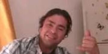 El hombre tiene una marca de una quemadura en la cara.