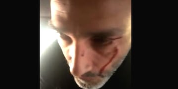 El chofer del Negro Videla apenas ocurrida la agresión que denunció el cantante por parte de un efectivo de la Caminera. (Captura video)
