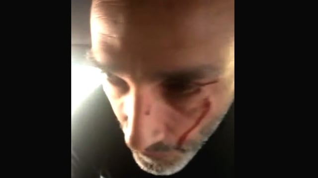 El chofer del Negro Videla apenas ocurrida la agresión que denunció el cantante por parte de un efectivo de la Caminera. (Captura video)