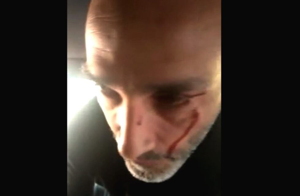 “El policía me pegó con el palo que usan para frenar los autos”, denunció el chofer de El Negro Videla