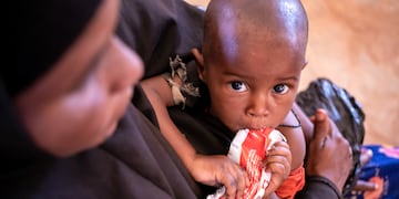 Qué es el ATLU, el alimento especial creado para combatir la desnutrición infantil y salvar vidas