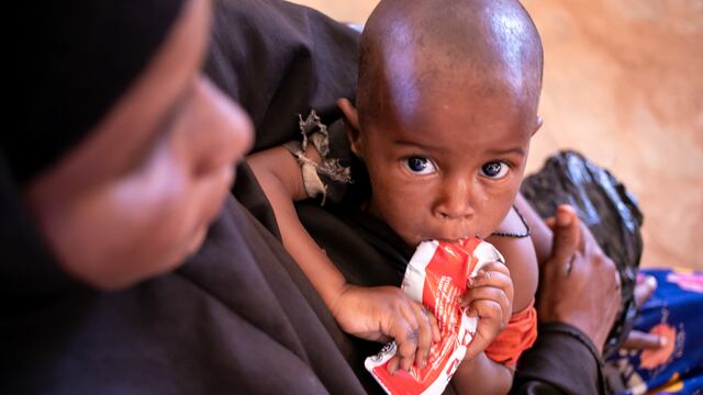 Qué es el ATLU, el alimento especial creado para combatir la desnutrición infantil y salvar vidas