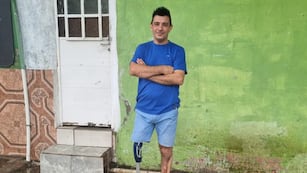 Le devolvieron su prótesis al cordobés asaltado. (Foto: El Doce)