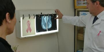 Se trata del tumor más frecuente entre las mujeres. (La Voz/Archivo)