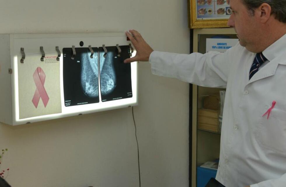 En Córdoba se diagnostican hasta 1.500 casos de cáncer de mama por año