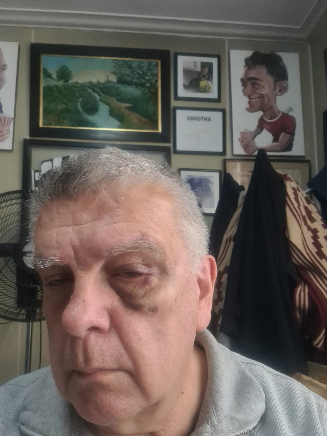 Luis Ventura mostró cómo quedó tras la agresión