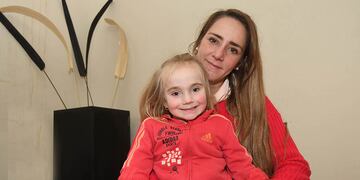 Juanita de 4 añitos ,padece de la enfermedad de agenesia de radio y mano bot. Sortearán un lote para reunir el dinero de la operación.