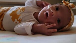 Ella es Evelyn, la bebé prematura santiagueña que lucha por sanar.