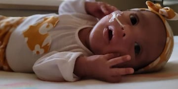Ella es Evelyn, la bebé prematura santiagueña que lucha por sanar.