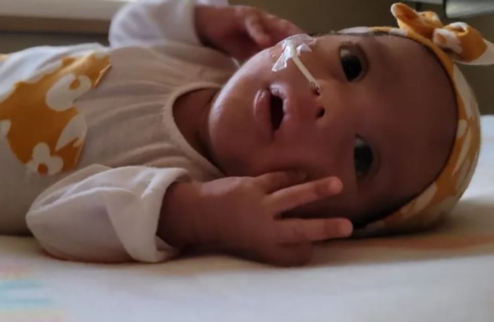 Llamado a la solidaridad: una bebé prematura santiagueña padece una extraña enfermedad y necesita ayuda para su tratamiento