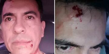 Agredieron al locutor Daniel Laurín.