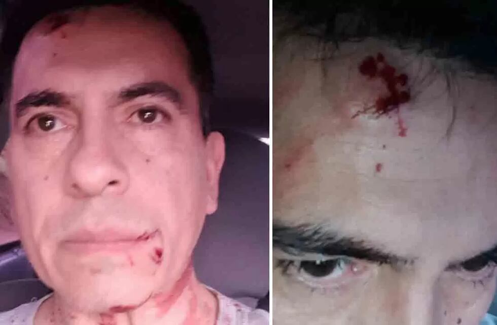 Conocido locutor bahiense recibe una golpiza tras una discusión