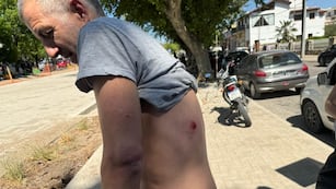 Lo agarraron a los piedrazos por chocar un perro en Córdoba.