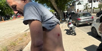 Lo agarraron a los piedrazos por chocar un perro en Córdoba.
