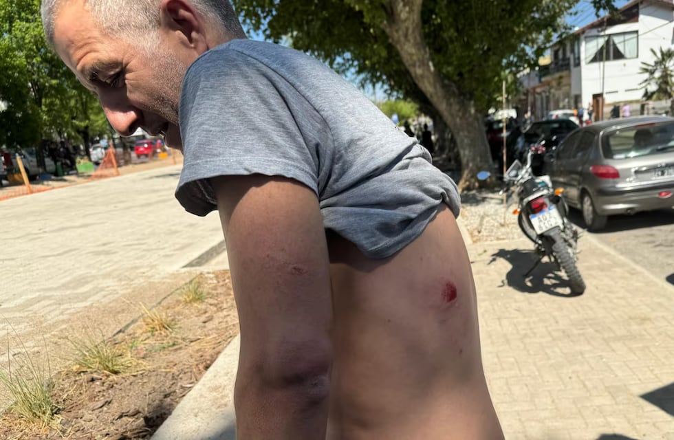 Chocó a un perro, bajó a auxiliarlo y fue atacado a piedrazos en Córdoba