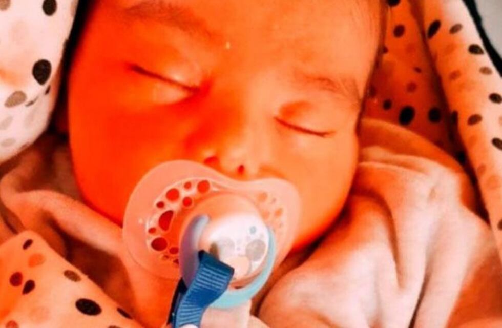 Estafaba a gente usando la foto de Pedro, el bebé de un mes que necesita ser operado