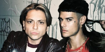 El terrible accidente de Paco Amoroso: se cayó del escenario en pleno show y terminó internado