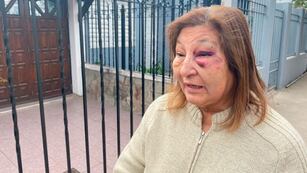 La mujer sufrió el violento asalto y terminó con lesiones. (Gentileza El Doce)