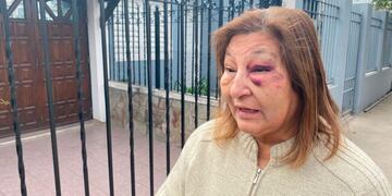 La mujer sufrió el violento asalto y terminó con lesiones. (Gentileza El Doce)