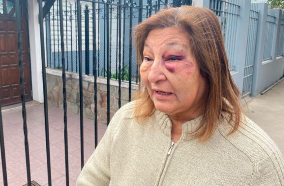 Inseguridad en Córdoba: le quisieron robar el auto a una jubilada, se colgó de la puerta y terminó herida