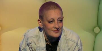 El especial beneficio que tiene Furia de Gran Hermano 2024 por su enfermedad