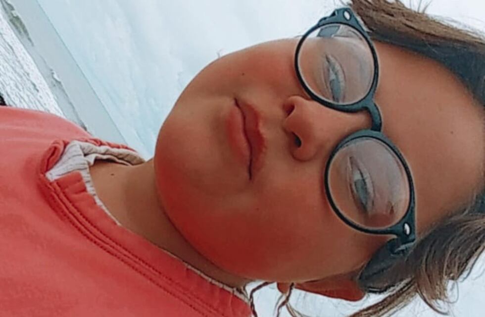 Le descubrieron una enfermedad en los ojos y puede perder la vista: necesita 1.600 dólares para la operación