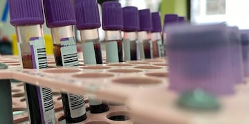 Seis casos de viruela del mono fueron detectados en Chile. Foto: Web