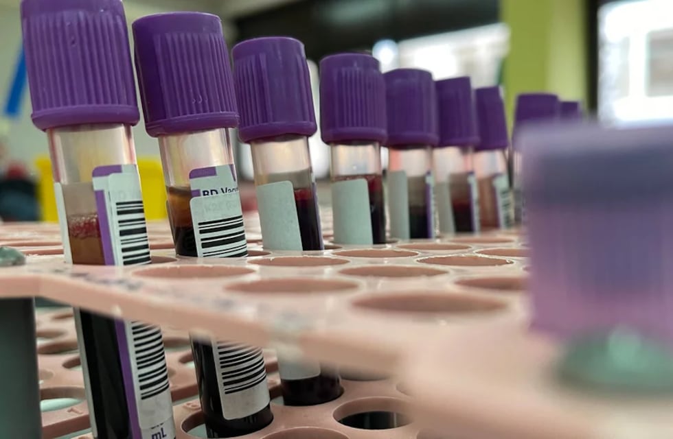 Alerta sanitaria en Chile: el país trasandino confirmó seis casos de viruela del mono