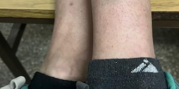 Una joven fue secuestrada y logró escapar.
