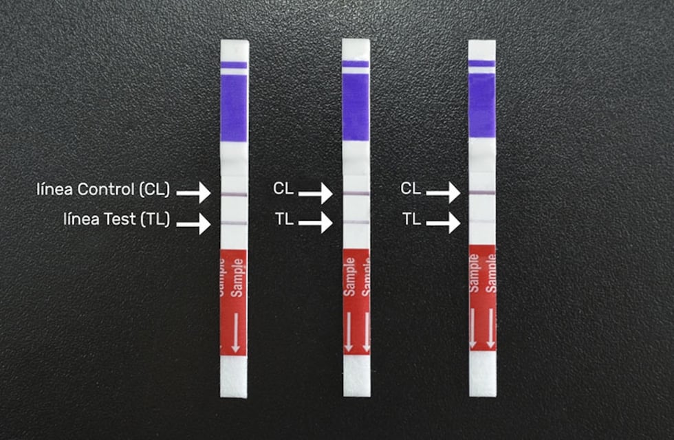 San Juan compró 3.000 test rápidos para detectar dengue