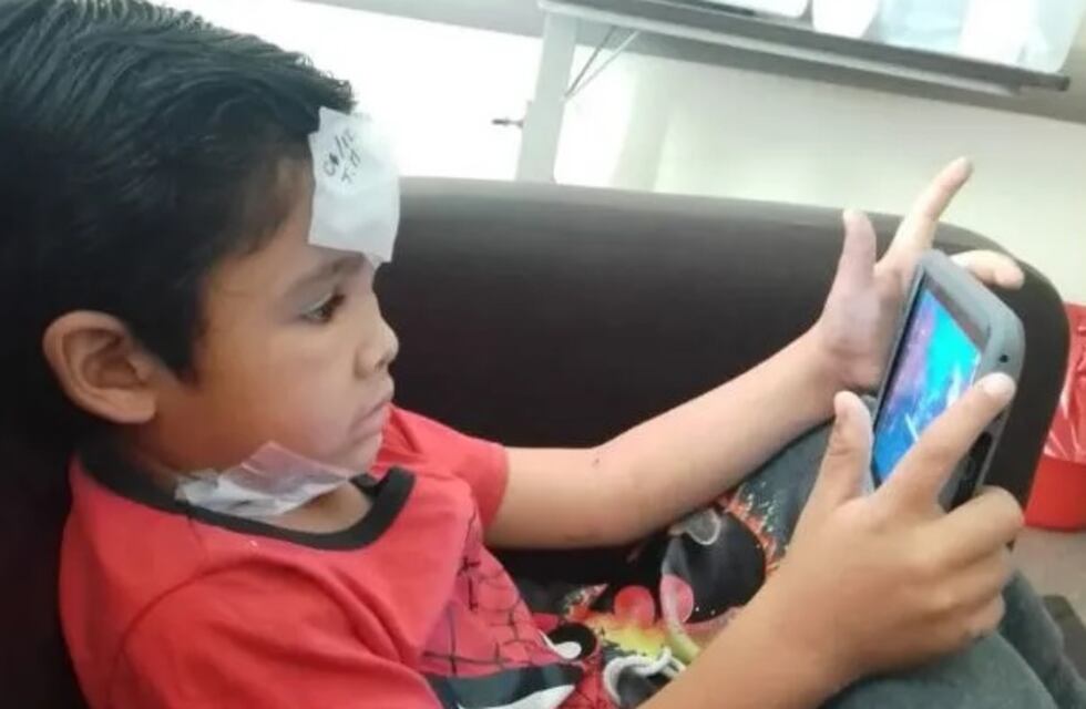 El milagro de Lisandro: sufrió una descarga eléctrica al tocar un cable de la calle, estuvo grave y ahora se recupera