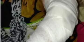 El perro de su hermana la mordió y debió ser asistida.