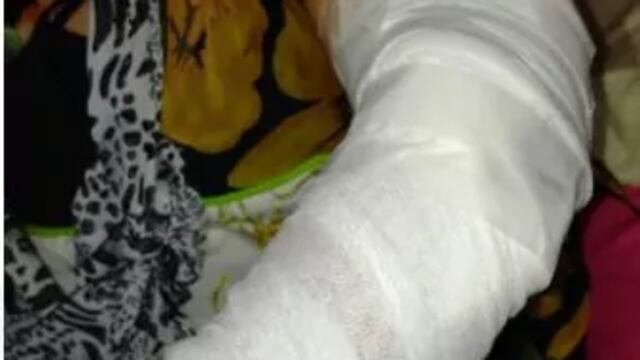 El perro de su hermana la mordió y debió ser asistida.