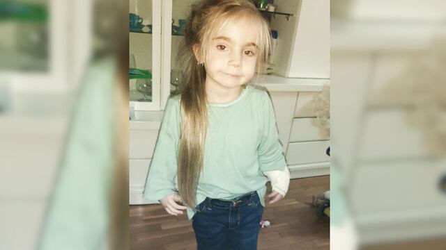 Juanita Ghiotti, la pequeña mendocina que había sido operada, deberá ser intervenida nuevamente.
