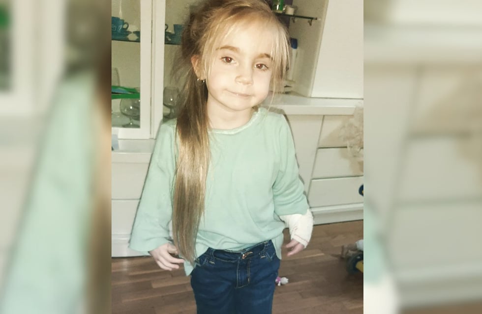 Juanita Ghiotti, la pequeña mendocina que había sido operada de sus manitos, deberá ser intervenida nuevamente