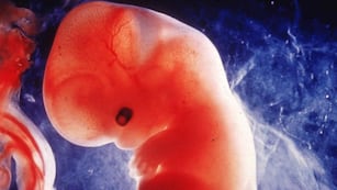 ¿Por qué el caso de los fetos guardados en el Hospital de Rafaela es tan importante para el sector ProVida?