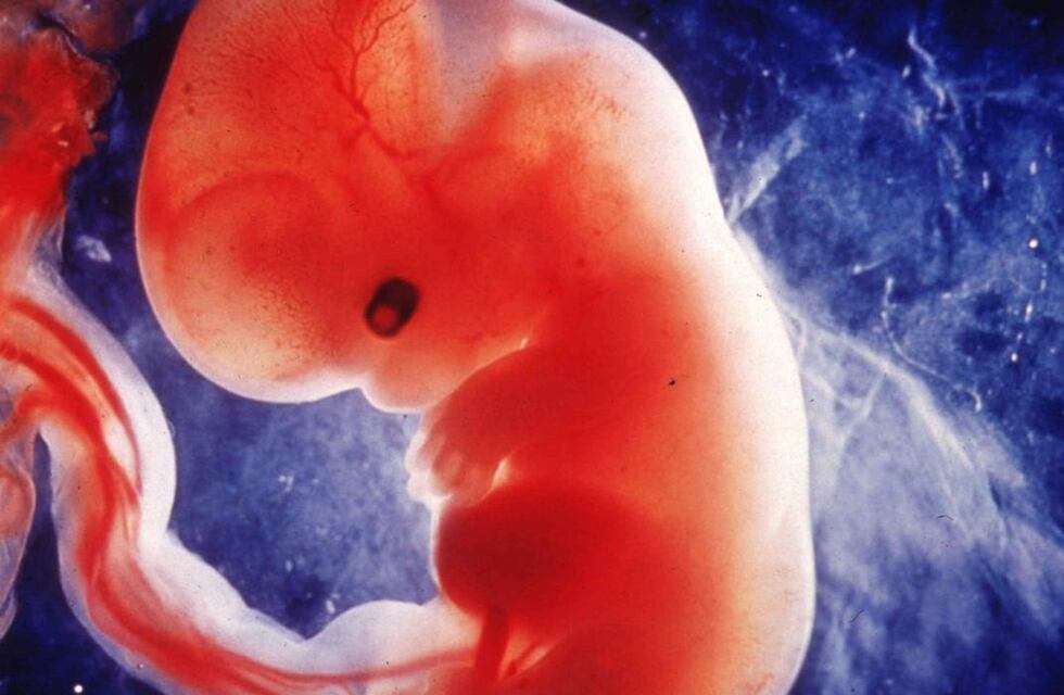 ¿Por qué el caso de los fetos guardados en el Hospital de Rafaela es tan importante para el sector ProVida?