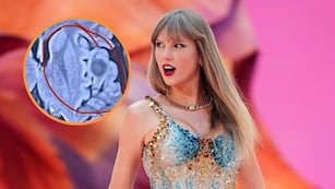 El insólito caso de la joven que descubrió que tenía una enfermedad gracias a una canción de Taylor Swift