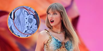 El insólito caso de la joven que descubrió que tenía una enfermedad gracias a una canción de Taylor Swift