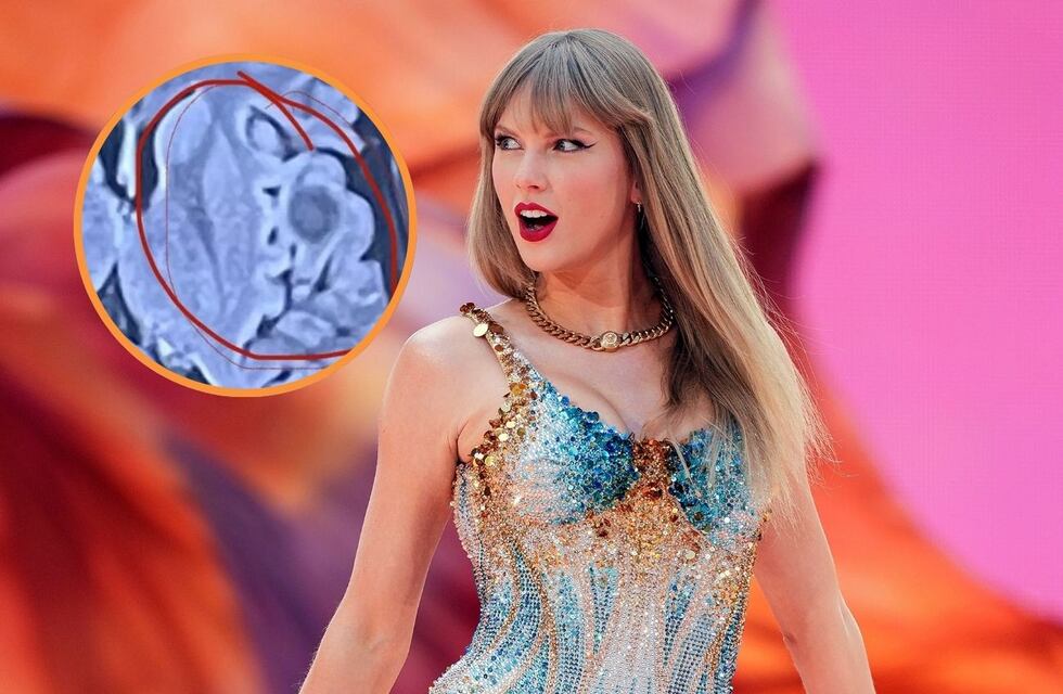 El insólito caso de la joven que descubrió que tenía una enfermedad gracias a una canción de Taylor Swift